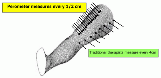 Juzo Perometer